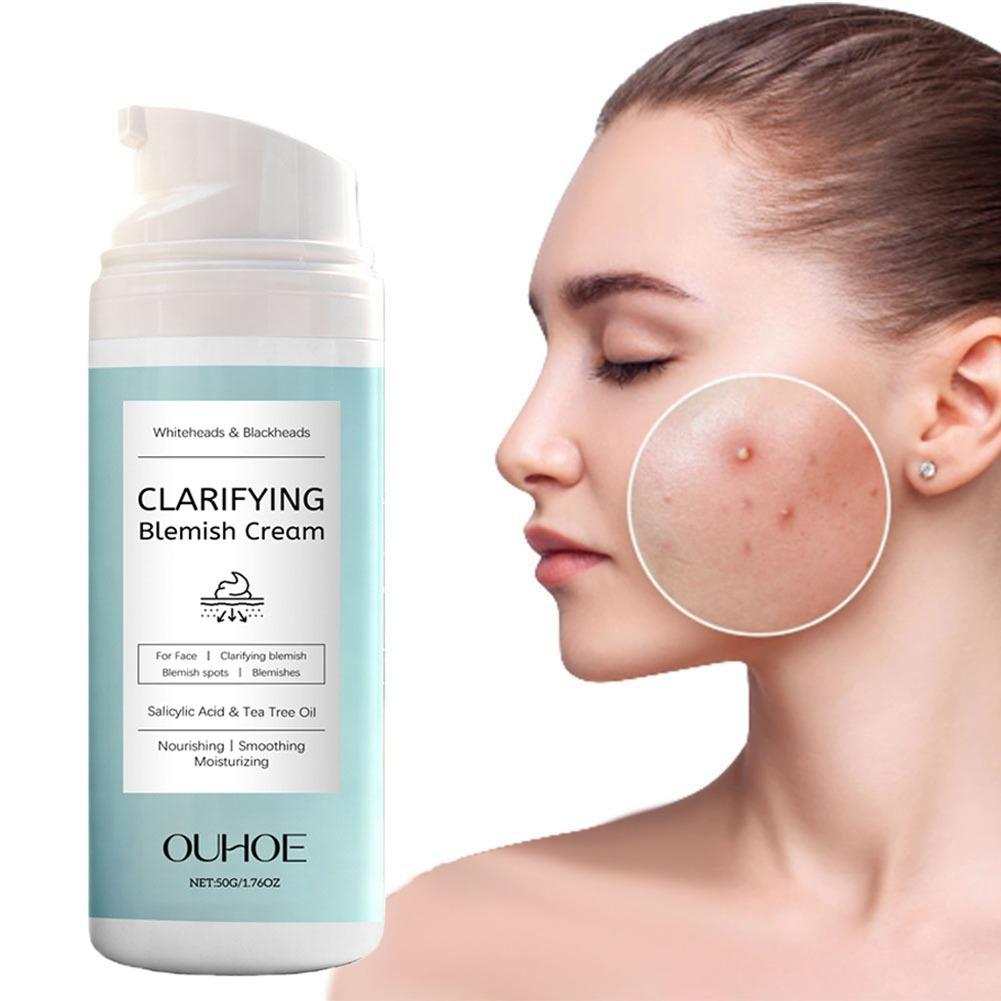 Krem z kwasem salicylowym na t – Salicylic Acid Blackhead Remover recenzja i cena